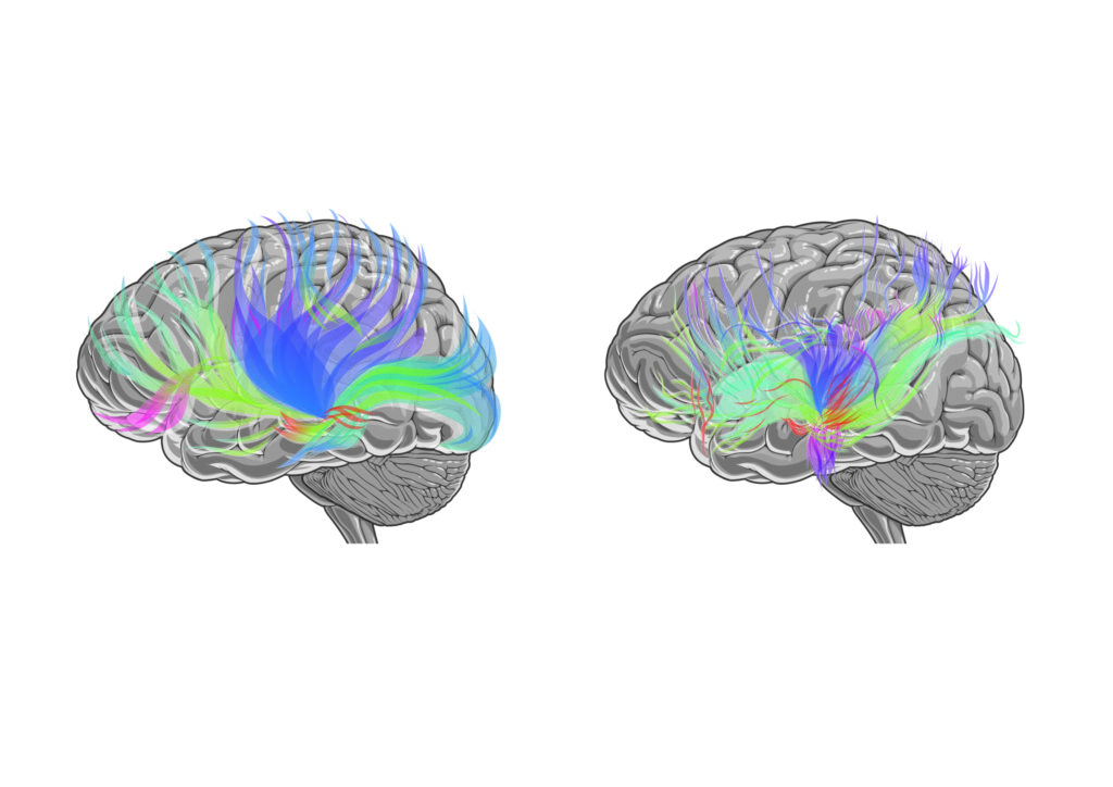 Image of a brain with broken neural connections